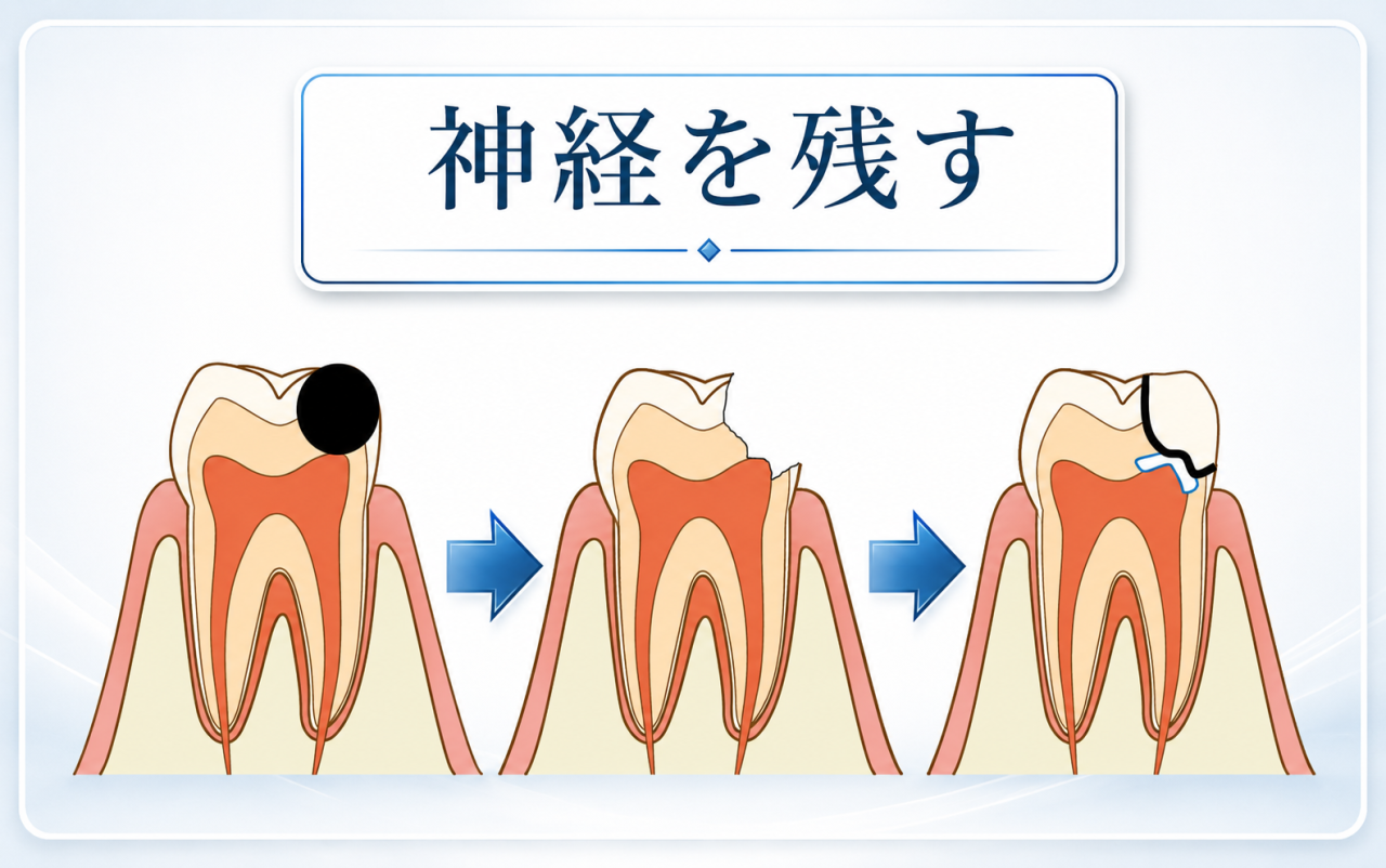 【画像あり】神経を残す治療（VPT）を院長が詳しく説明します
