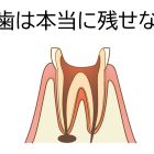 抜歯と言われた歯は本当に残せない？歯医者の専門分野による治療の考え方の違いについて