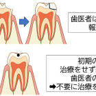 歯を守るために大切なのは「できるだけ治療しない」考え方です