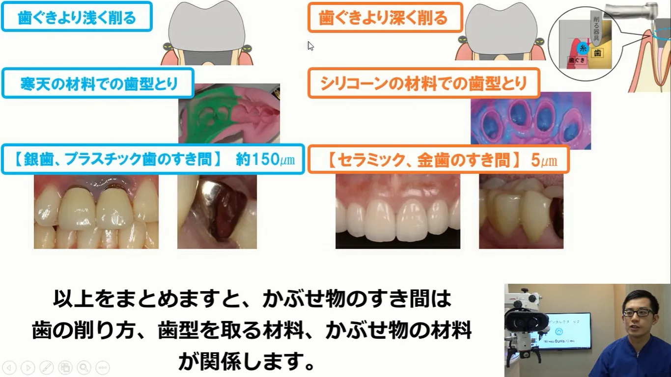 歯を長持ちさせる、かぶせ物について動画で説明します