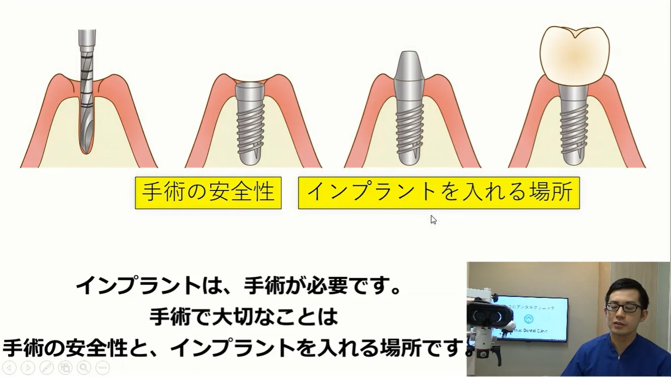 安全で理想的なインプラント治療について動画で説明します。