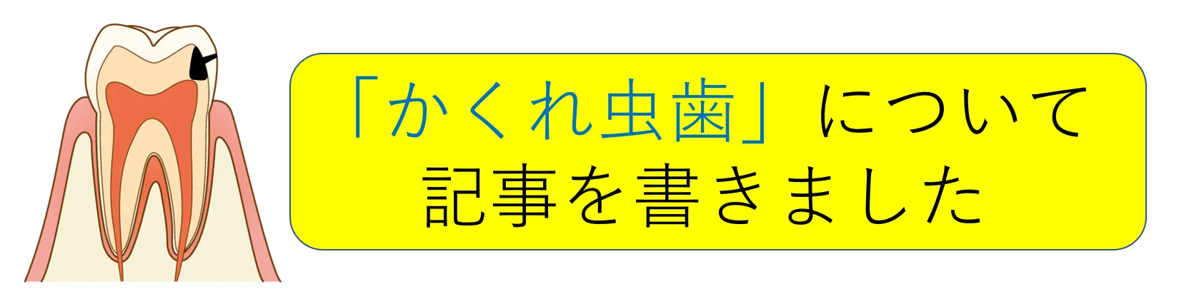 「かくれ虫歯」についてネットで記事を書きました