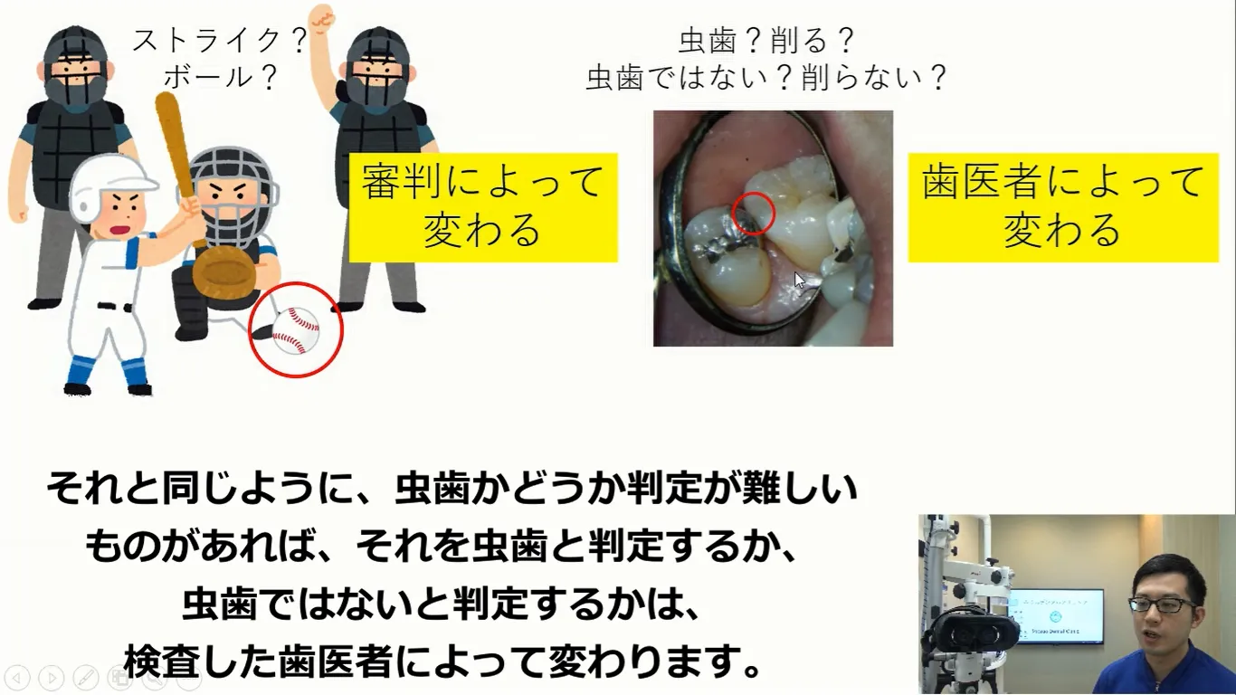虫歯検査にもビデオ判定が必要です。