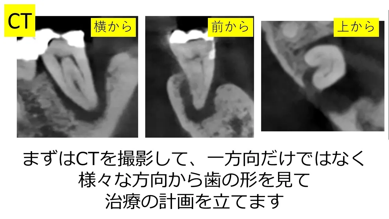 CT検査の画像（横から・前から・上から）