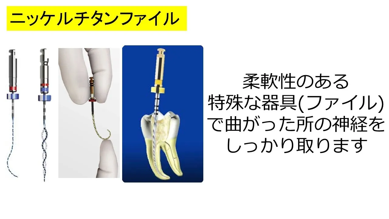 ニッケルチタンファイル