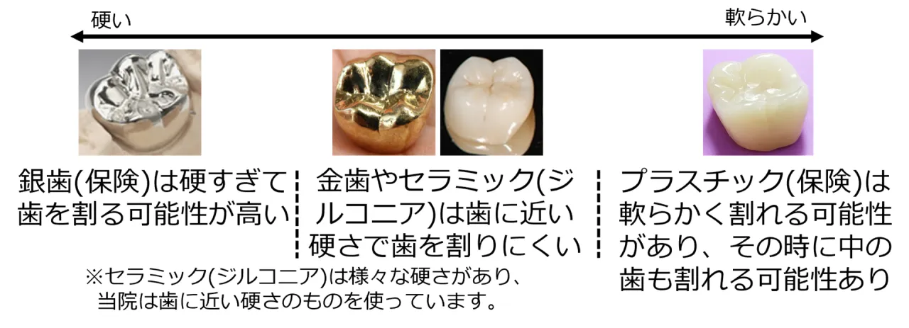 銀歯(保険)は硬すぎて歯を割る可能性が高く、金歯やセラミック(ジルコニア)は歯に近い硬さで歯を割りにくく、プラスチック(保険)は軟らかく割れる可能性があることを示す比較図